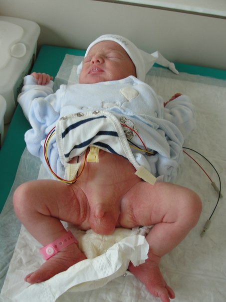 №9, Александр Эллерс, 9.8.1978 №9, Александр Эллерс, 9.8.1978